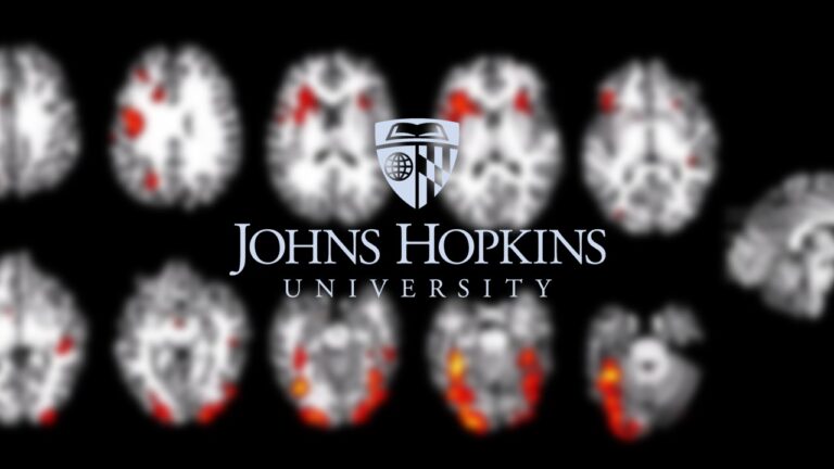 Principios de fMRI